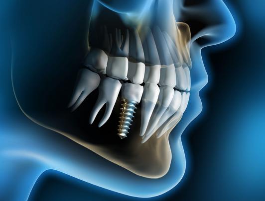 Dental Desktop Wallpapers