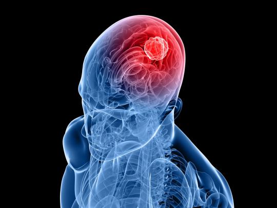 Brain Anatomy Wallpapers (62+ background pictures)
